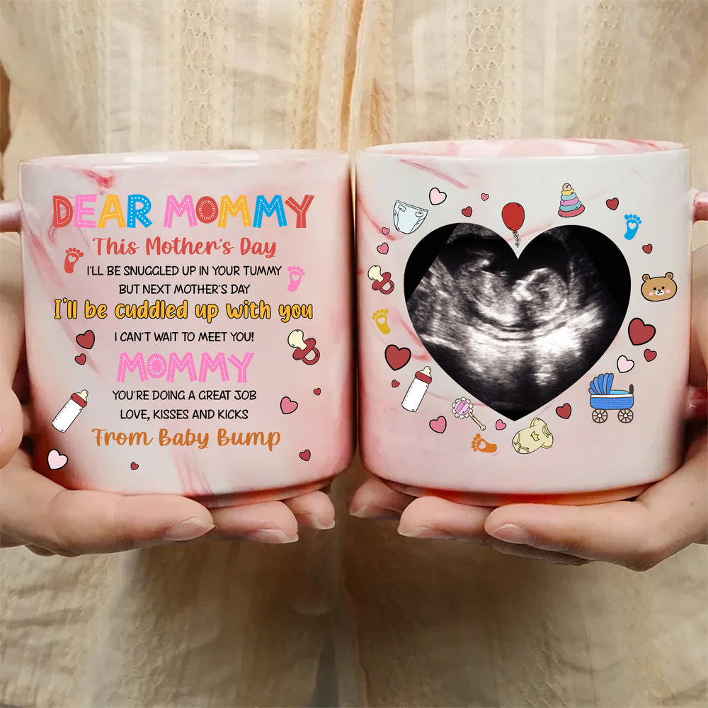 Cherish Every Moment: Custom Ultrasound Photo Mug for Mother's Day
